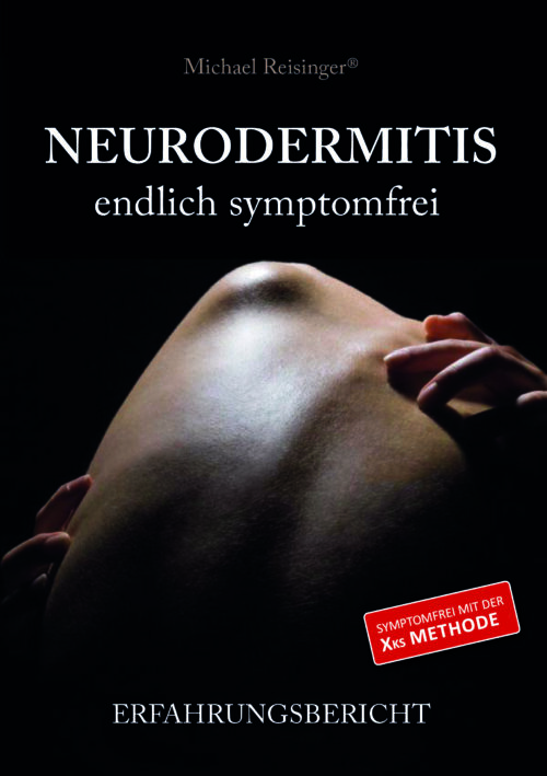 Neurodermitis - endlich symptomfrei